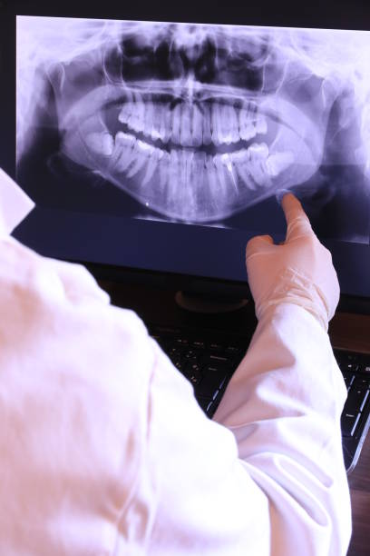 Best Emergency Tooth Extraction in West Crossett, AR