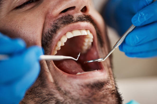 Best Same-Day Emergency Dentist in West Crossett, AR